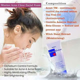Mistine Acne Clear Facial Foam - 85ml - Buy Online in Pakistan at Cosmia.pk