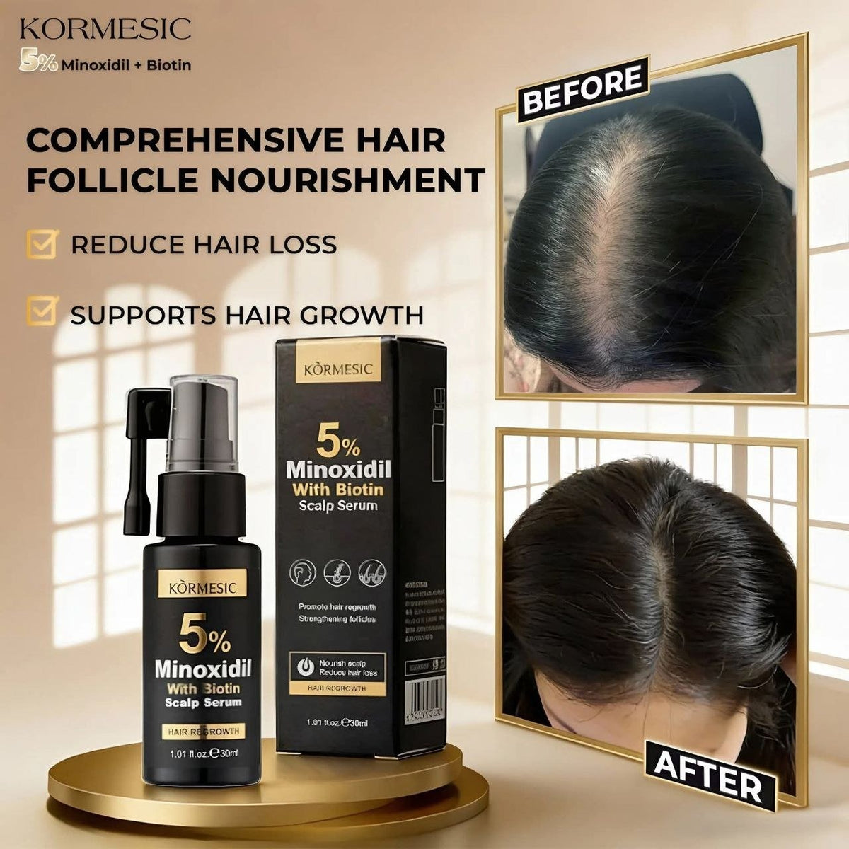 Kormesic 5% Minoxidil With Biotin Hair Care Set Price in Pakistan | Cosmia.pk