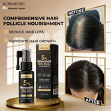 Kormesic 5% Minoxidil With Biotin Hair Care Set Price in Pakistan | Cosmia.pk