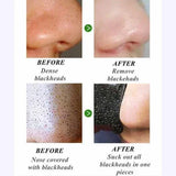 Dear She Charcoal Nose Pore Cleansing 10 Strips - Buy Online in Pakistan at Cosmia.pk