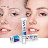 Bioaqua Acne Removal Cream Spot-Free Skin - 30g - Buy Online in Pakistan at Cosmia.pk