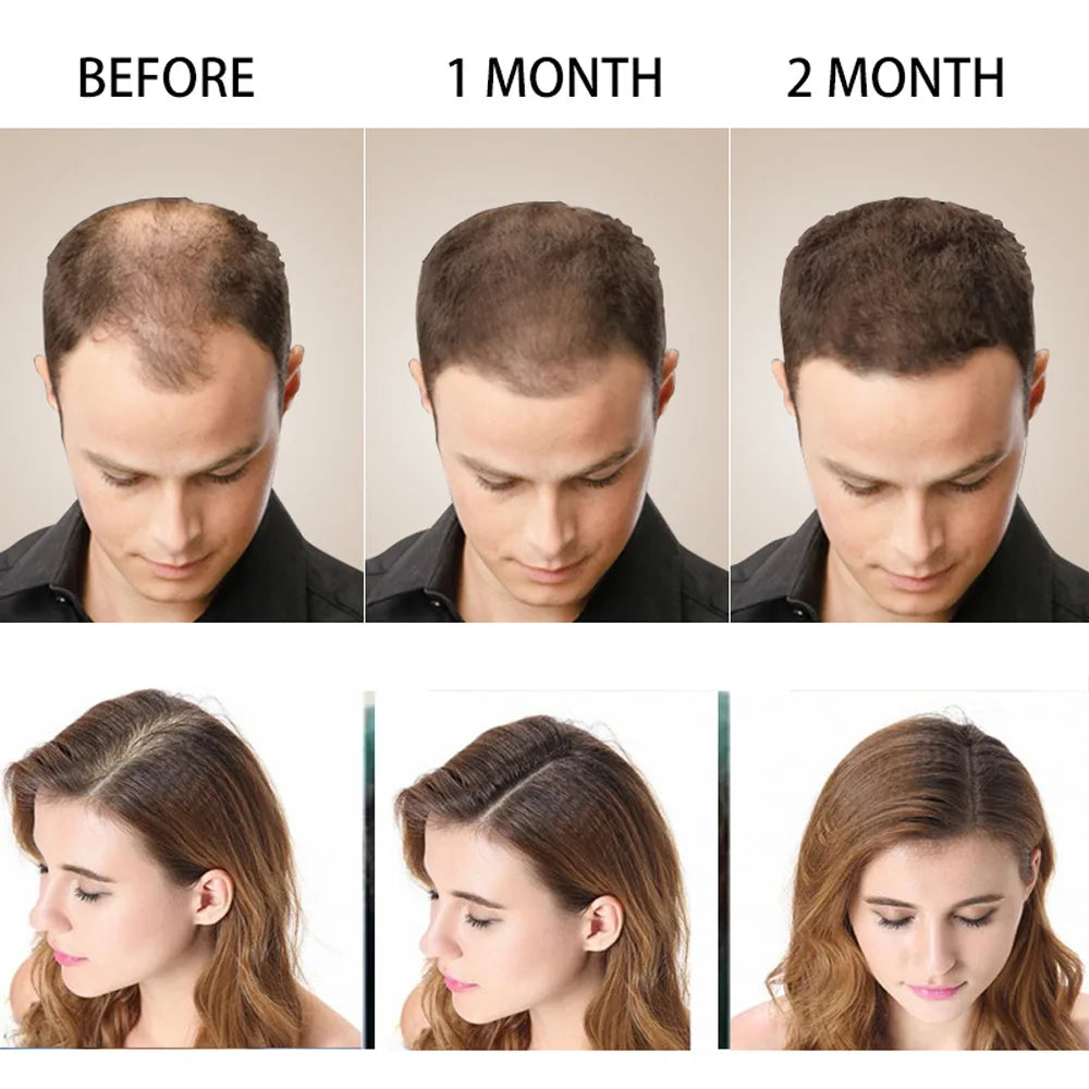 Disaar Hair Shampoo Anti-Hair Loss - 200ml - Buy Online in Pakistan at Cosmia.pk