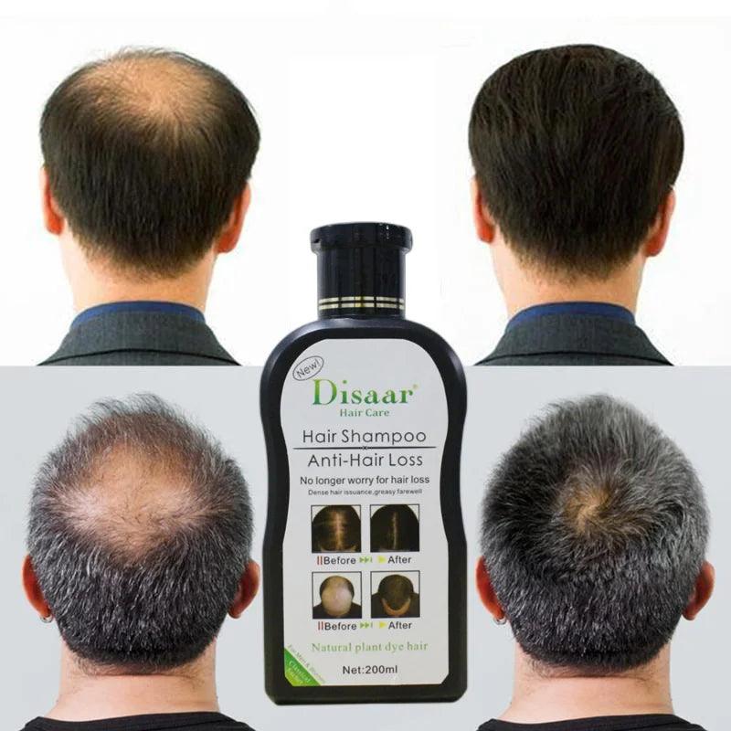 Disaar Hair Shampoo Anti-Hair Loss - 200ml - Buy Online in Pakistan at Cosmia.pk