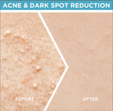 Garnier Skin Active Fast Clear Booster Serum For Acne Prone Skin - Buy Online in Pakistan at Cosmia.pk