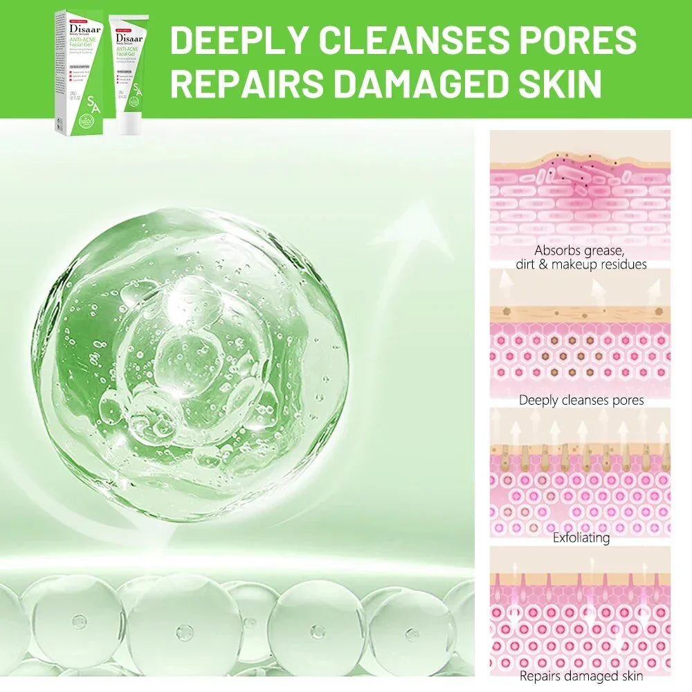 Disaar ceramide Anti-Acne Facial Gel Moisturizing Face Gel - 30g - Buy Online in Pakistan at Cosmia.pk