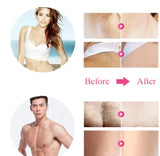 Babyverse IPL Laser Epilator Women Laser Hair Removal - Buy Online in Pakistan at Cosmia.pk