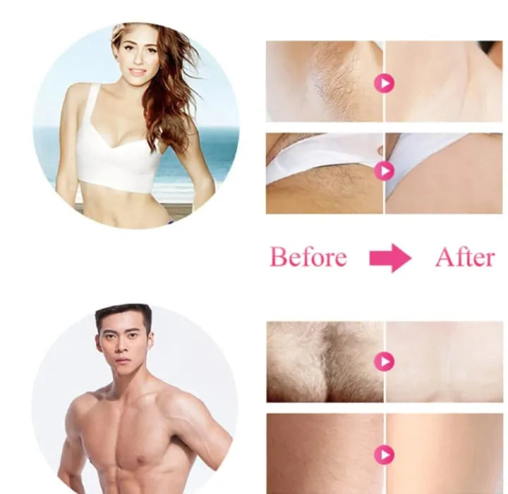 Babyverse IPL Laser Epilator Women Laser Hair Removal - Buy Online in Pakistan at Cosmia.pk