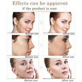 Bioaqua Avocado Moisturizer-Face Whitening Cream - 50gm - Buy Online in Pakistan at Cosmia.pk