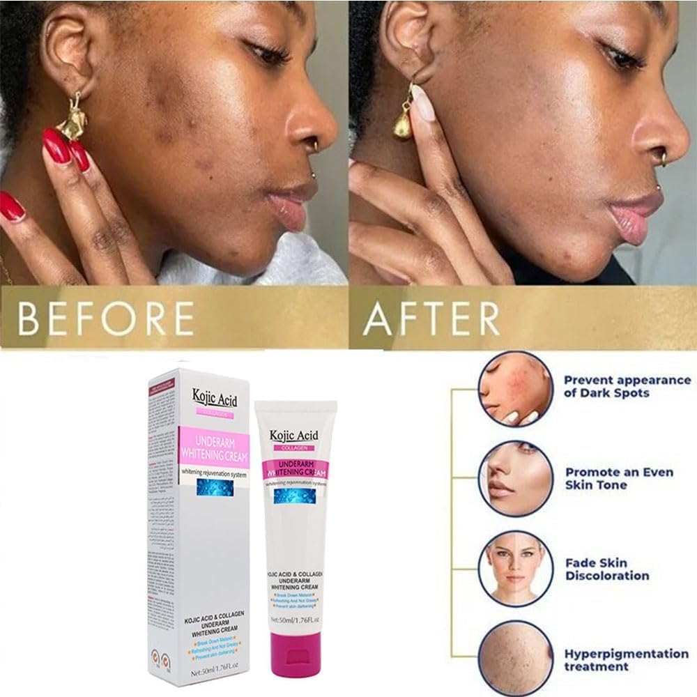 Guanjing Kojic Acid & Collagen Underarm Whitening Cream – 50ml - Buy Online in Pakistan at Cosmia.pk