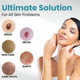 Non-Invasive Mole and Wart Removal Pen - Buy Online in Pakistan at Cosmia.pk