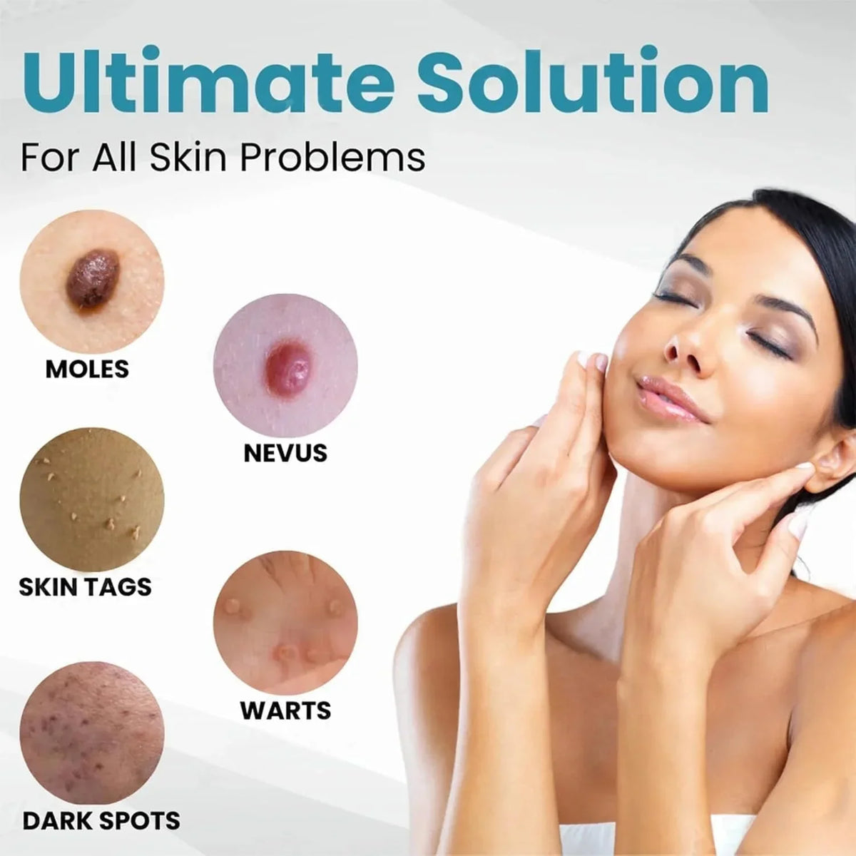 Non-Invasive Mole and Wart Removal Pen - Buy Online in Pakistan at Cosmia.pk