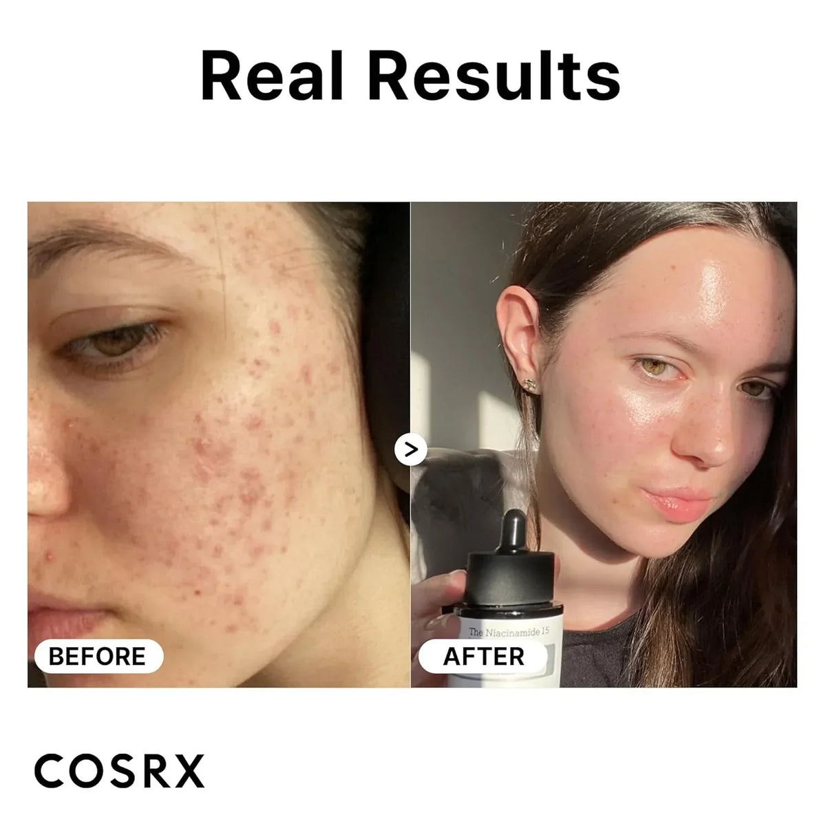 COSRX Niacinamide 15% Face Serum - 20ml - Buy Online in Pakistan at Cosmia.pk