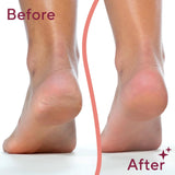 Flawless Pedi electronic pedicure tool - Buy Online in Pakistan at Cosmia.pk