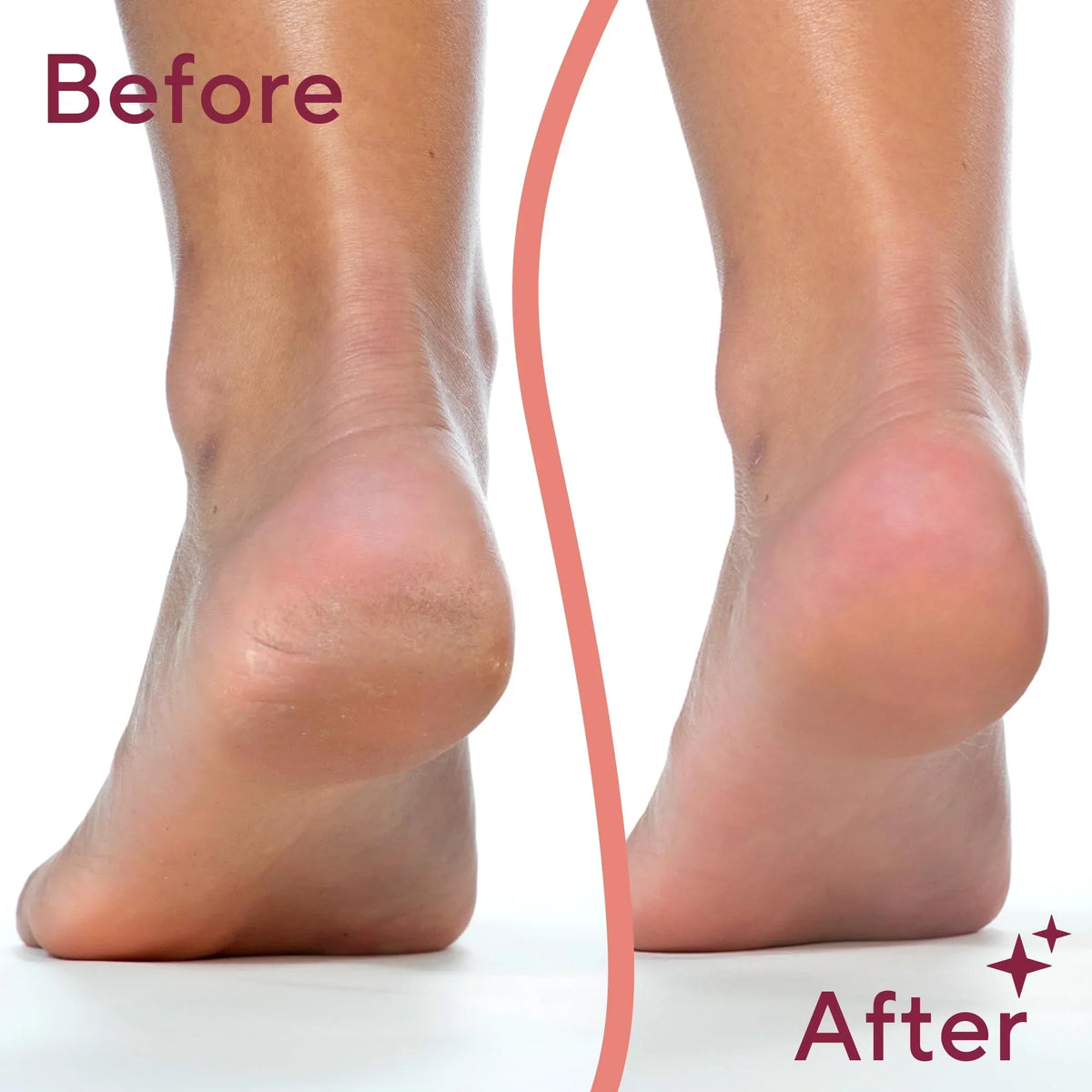 Flawless Pedi electronic pedicure tool - Buy Online in Pakistan at Cosmia.pk