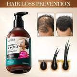 SADOER Anti Hair Loss Shampoo Anti-dandruff Hair Growth Shampoo - 300ml - Buy Online in Pakistan at Cosmia.pk