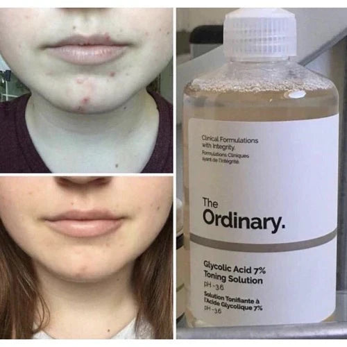 The Ordinary Glycolic Acid 7% Toning Solution - 240ml - Buy Online in Pakistan at Cosmia.pk