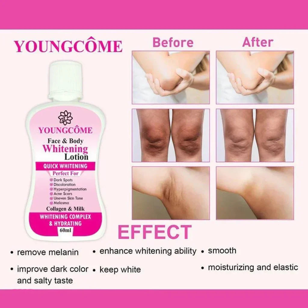 Youngcome Face & Body Whitening Lotion – 60ml - Buy Online in Pakistan at Cosmia.pk