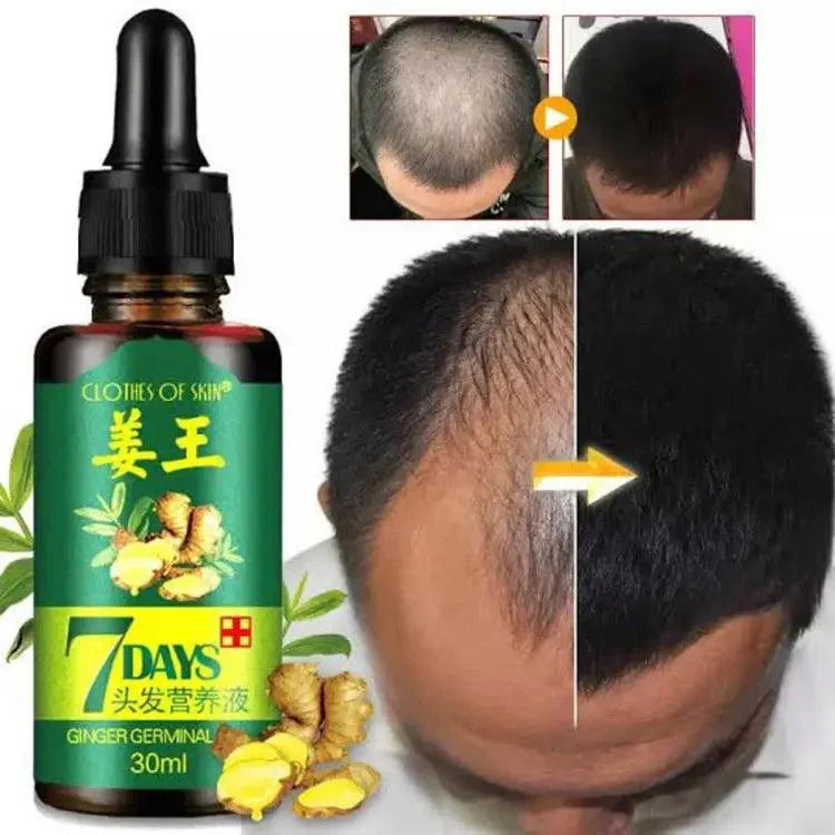7 Days Hair Growth Germinal Serum - 30ml - Buy Online in Pakistan at Cosmia.pk