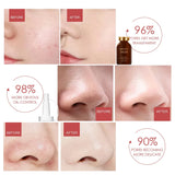 MUICIN - Shrink Pores Hyaluronic Acid Serum - 30ml - Buy Online in Pakistan at Cosmia.pk
