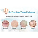 Bioaqua Acne Removal Cream Spot-Free Skin - 30g - Buy Online in Pakistan at Cosmia.pk