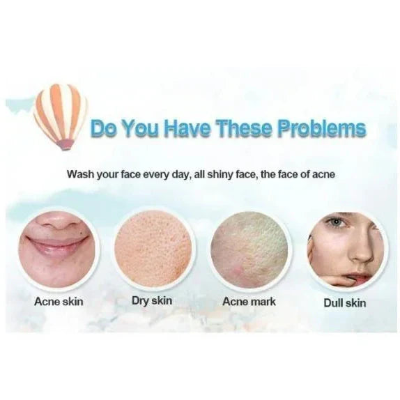 Bioaqua Acne Removal Cream Spot-Free Skin - 30g - Buy Online in Pakistan at Cosmia.pk