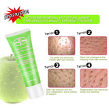 AICHUN BEAUTY Private Parts ,Underarm Glowing Body Care Cream - 50g - Buy Online in Pakistan at Cosmia.pk
