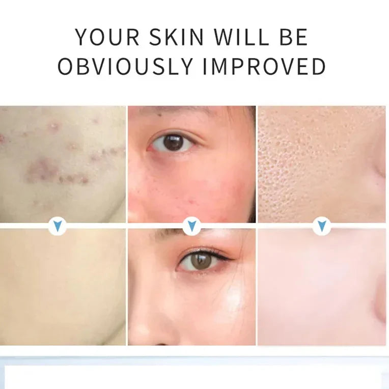 AICHUN BEAUTY Salicylic Acid Purifying Shrink Pores Exfoliation - Buy Online in Pakistan at Cosmia.pk