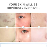 AICHUN BEAUTY Salicylic Acid Purifying Shrink Pores Exfoliation - Buy Online in Pakistan at Cosmia.pk