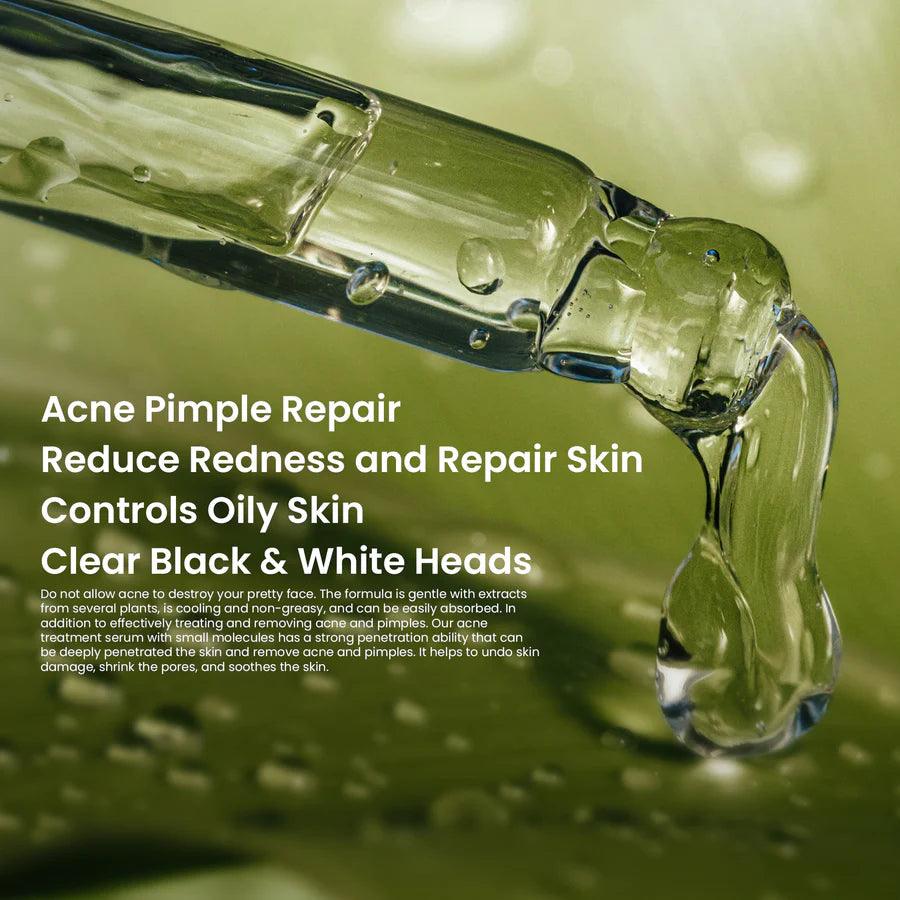 Rivaj Acne Treatment Serum - 30ml - Buy Online in Pakistan at Cosmia.pk