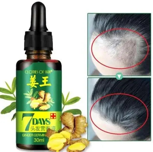 Aichun Beauty 7 Days Ginger Hair Growth Oil Serum For Damaged Hair - Buy Online in Pakistan at Cosmia.pk