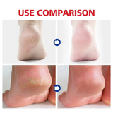 Aichun Beauty Foot Balm For Heel Cream– 20g - Buy Online in Pakistan at Cosmia.pk