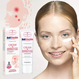 Aichun Beauty Remove Freckles Dark Spots Anti-Freckle Cream - Buy Online in Pakistan at Cosmia.pk