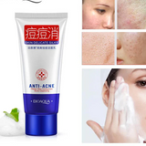 Bioaqua Anti‑Acne Pox Repair Pore Oil Control Anti‑Dirt Bubble Foam Face Wash Cleanser - 100g - Buy Online in Pakistan at Cosmia.pk