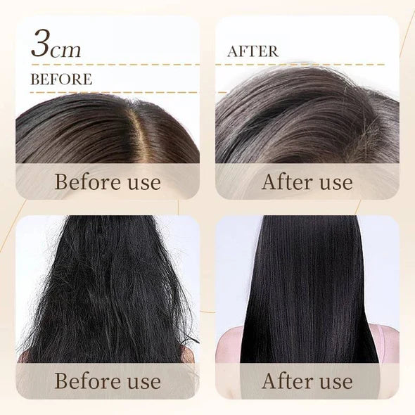 Bioaqua Rice Raw Pulp Removal Dandruff Shampoo - 500ml - Buy Online in Pakistan at Cosmia.pk