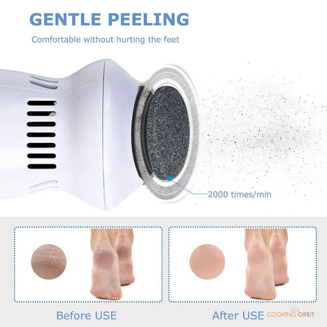Callus Remover With Built-In Vacuum Electric Foot Grinder - Buy Online in Pakistan at Cosmia.pk