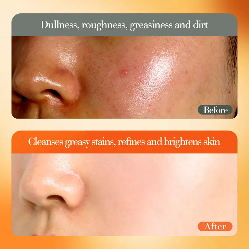 FAYANKOU Whitening Brightens Vitamin C Essence Cream - 50g - Buy Online in Pakistan at Cosmia.pk