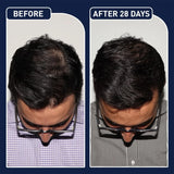 FEGPLUS Hair & Beard Growth Spary – 50ml - Buy Online in Pakistan at Cosmia.pk