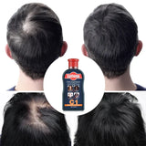 Pei Mei Caffeine Hair Shampoo Anti-Hair Loss - 200ml - Buy Online in Pakistan at Cosmia.pk