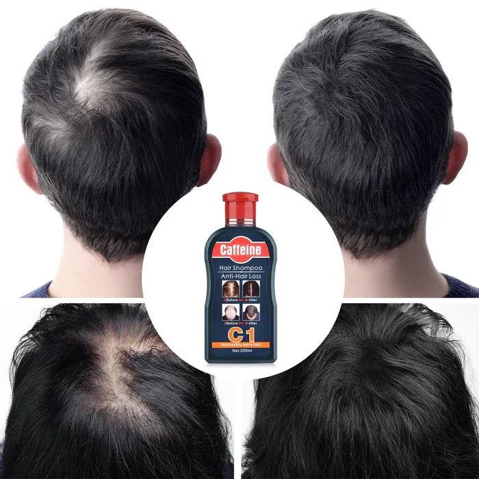 Pei Mei Caffeine Hair Shampoo Anti-Hair Loss - 200ml - Buy Online in Pakistan at Cosmia.pk