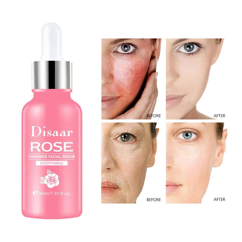 DISAAR Rose & Ceramide Soothing Facial Serum - 30ml - Buy Online in Pakistan at Cosmia.pk
