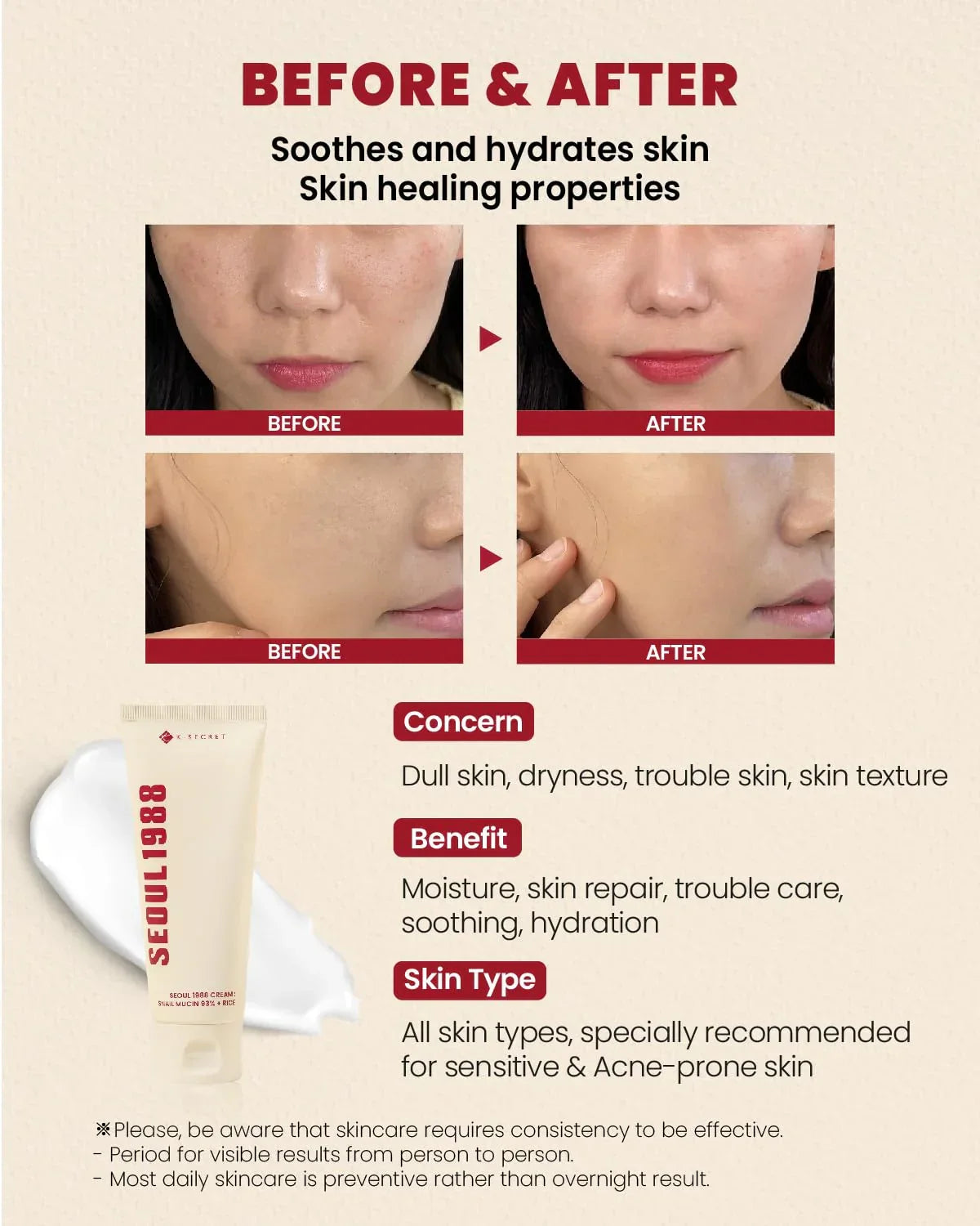 K-Secret Seoul 1988 Snail Mucin 93% + Rice Cream  - 100ml - Made in Korea - Buy Online in Pakistan at Cosmia.pk