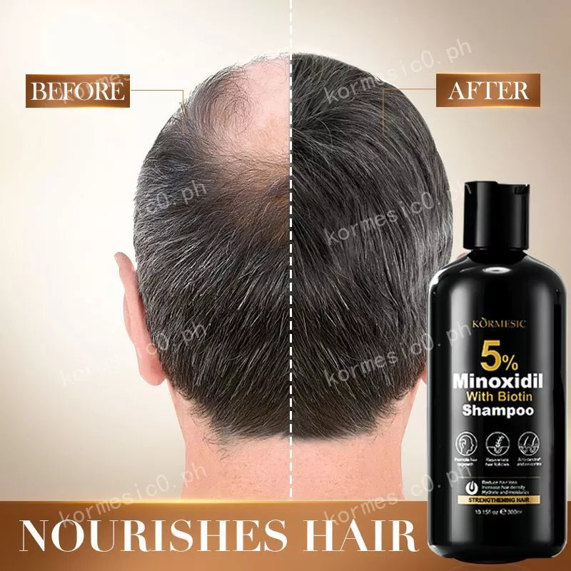 KORMESIC Minoxidil with Biotin Hair Grower Shampoo - 300ml - Buy Online in Pakistan at Cosmia.pk