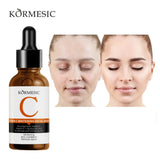KORMESIC Vitamin C Whitening Facial Serum - 30ml - Buy Online in Pakistan at Cosmia.pk