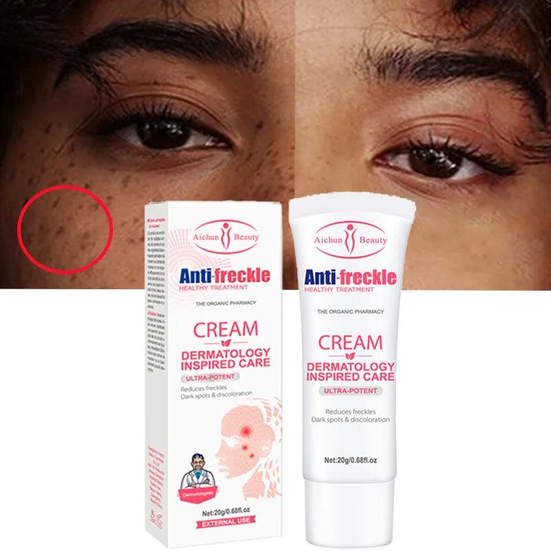 Aichun Beauty Remove Freckles Dark Spots Anti-Freckle Cream - Buy Online in Pakistan at Cosmia.pk