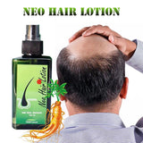 Neo Hair Lotion with Free Derma Roller (Made in P.R.C) - Buy Online in Pakistan at Cosmia.pk