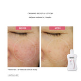 Physiogel Calming Relief A.i Lotion 200ml - Buy Online in Pakistan at Cosmia.pk