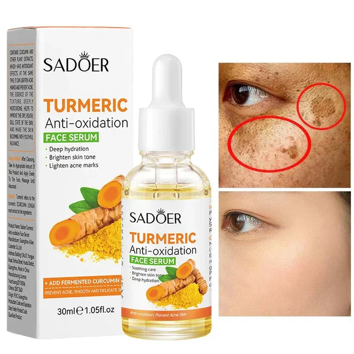 Sadoer Turmeric Anti Oxidation Face Serum - 30ml - Buy Online in Pakistan at Cosmia.pk