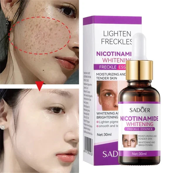 Sadoer Niacinamide Whitening Freckles Serum 30ml - Buy Online in Pakistan at Cosmia.pk