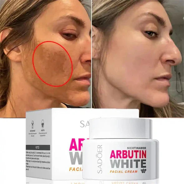 Sadoer Nicotinamide Arbutin White Facial Cream - 50g - Buy Online in Pakistan at Cosmia.pk