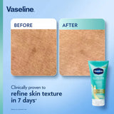 Vaseline Gluta-Hya Serum Burst Lotion Smoothing Perfector - Made in Thailand - Buy Online in Pakistan at Cosmia.pk